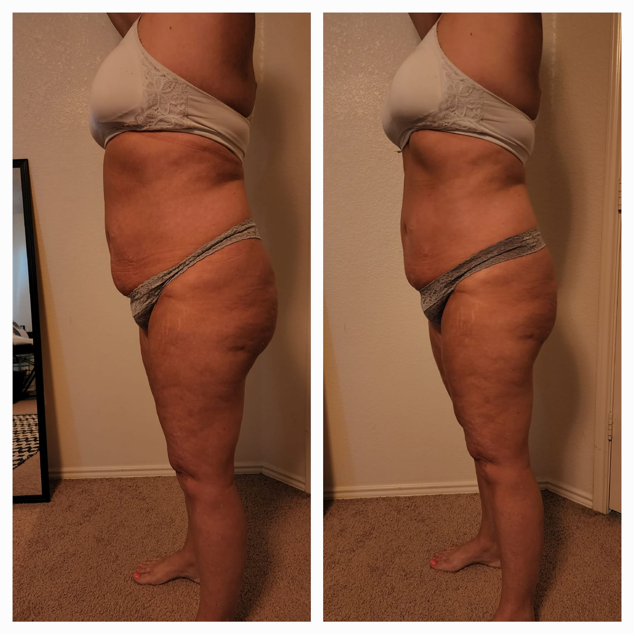 dose for retatrutide Doctor Explains How to to MAXIMIZE Fat Loss (not what you think) Weight Loss Program type:Tirzepatide (GLP-1 + GIP) are glp 1 patches protocol:bariatric-soft