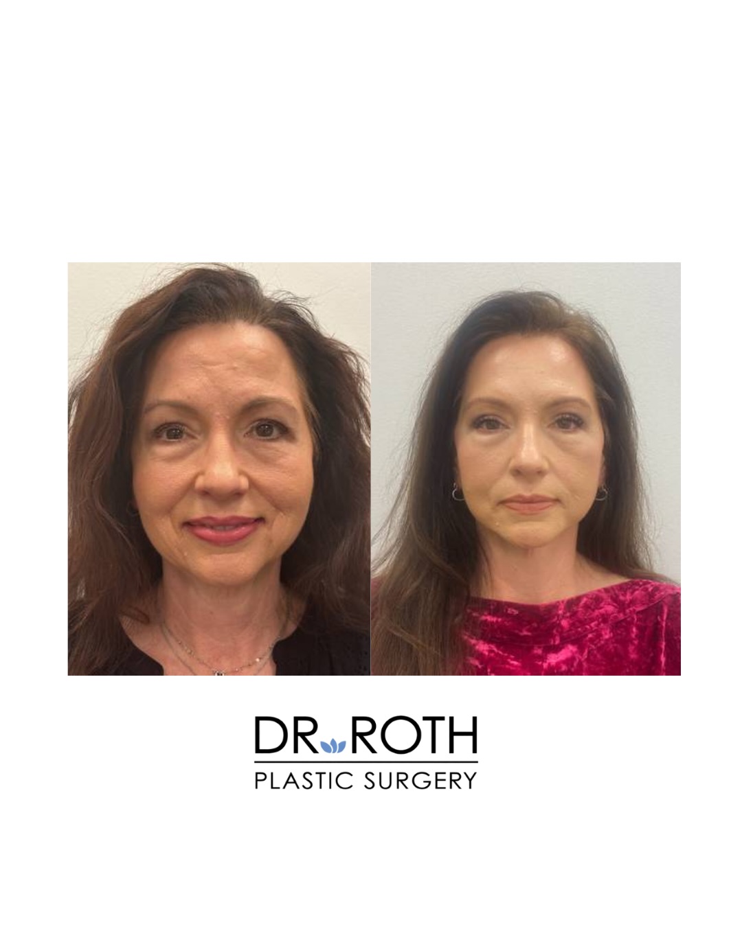 Dr. Roth Plastic Surgery | Houston TX