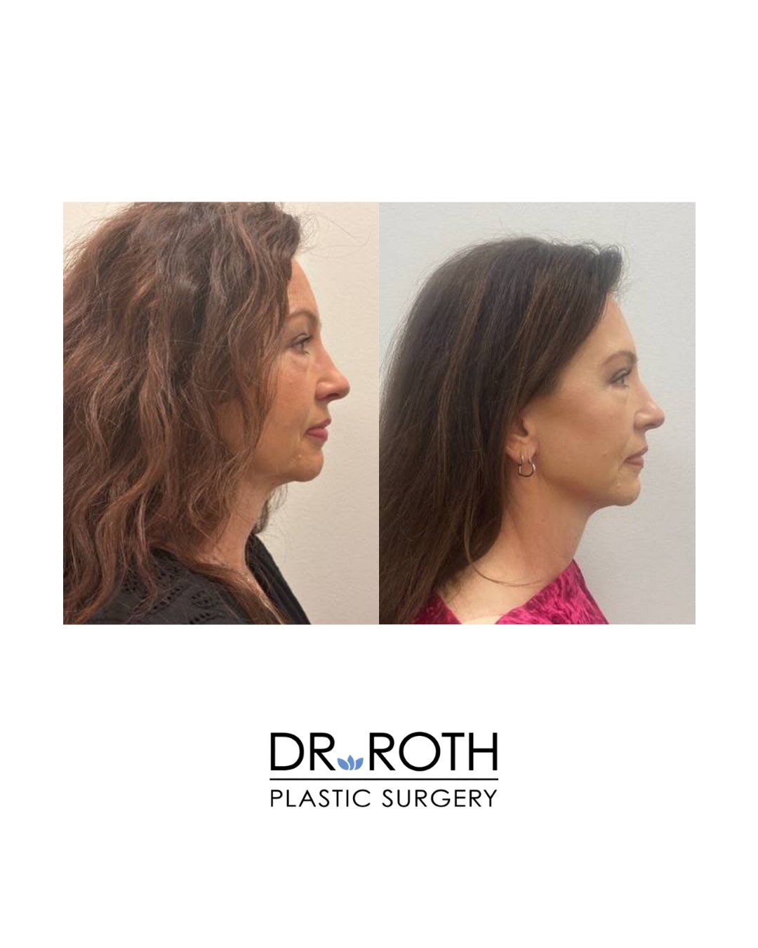 Dr. Roth Plastic Surgery | Houston TX