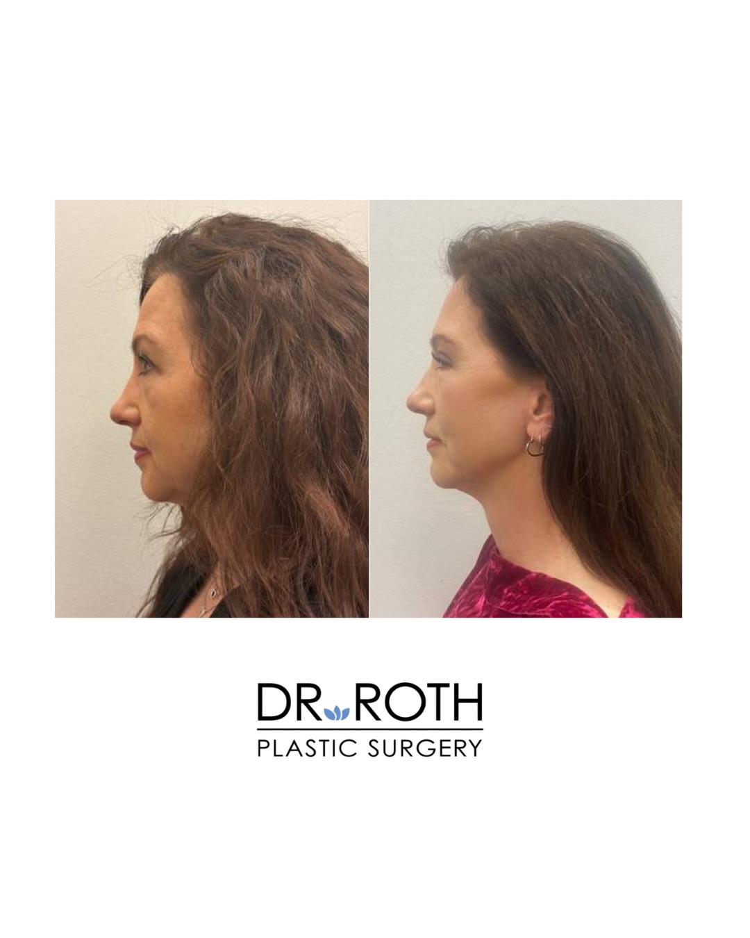 Dr. Roth Plastic Surgery | Houston TX