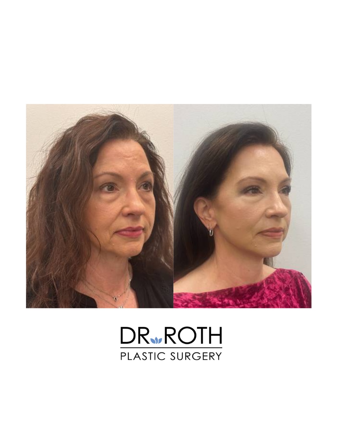 Dr. Roth Plastic Surgery | Houston TX