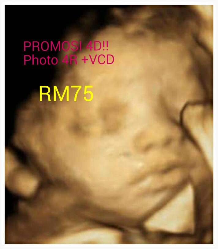 Klinik Dr Syila Kamunting Sempena Bulan Ramadan Al Mubarak Klinik Dr Syila Akan Mengadakan Promosi 4d Scan Gambar 4d Vcd Rm75 Sahaja Harga Biasa Rm88 Semua 4d Scan Akan Disertai Dengan Vcd Tiada