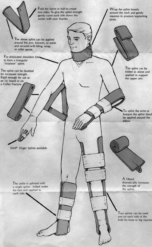 SAM SPLINT... - Global Emergency Medical Technicians Registry | Facebook