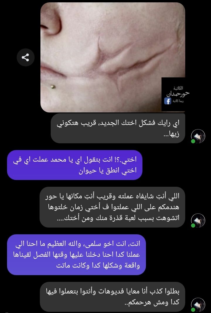 حور - نزلت جري من بيتي رايحة على بيت أختي، وعيوني بتدمع بوجع وخوف على ...