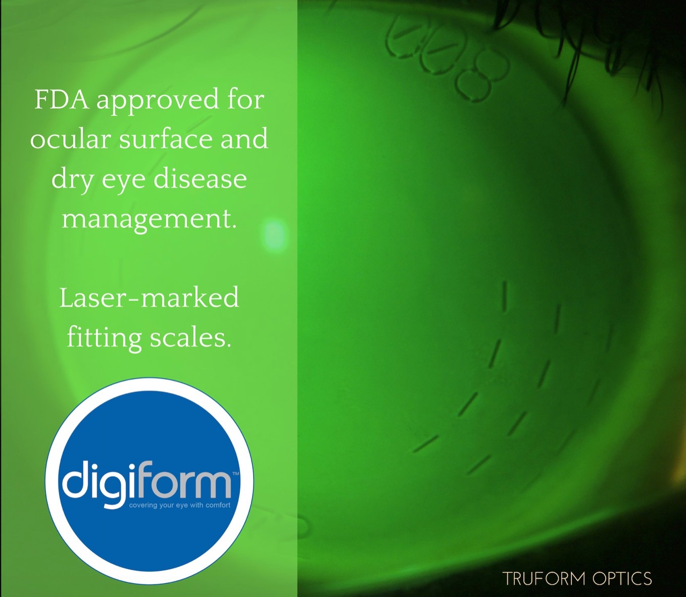TruForm Optics - DigiForm Scleral lenses have etched... | Facebook