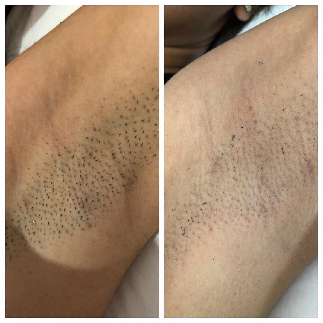Authentique Laser Spa Experience | Goderich ON