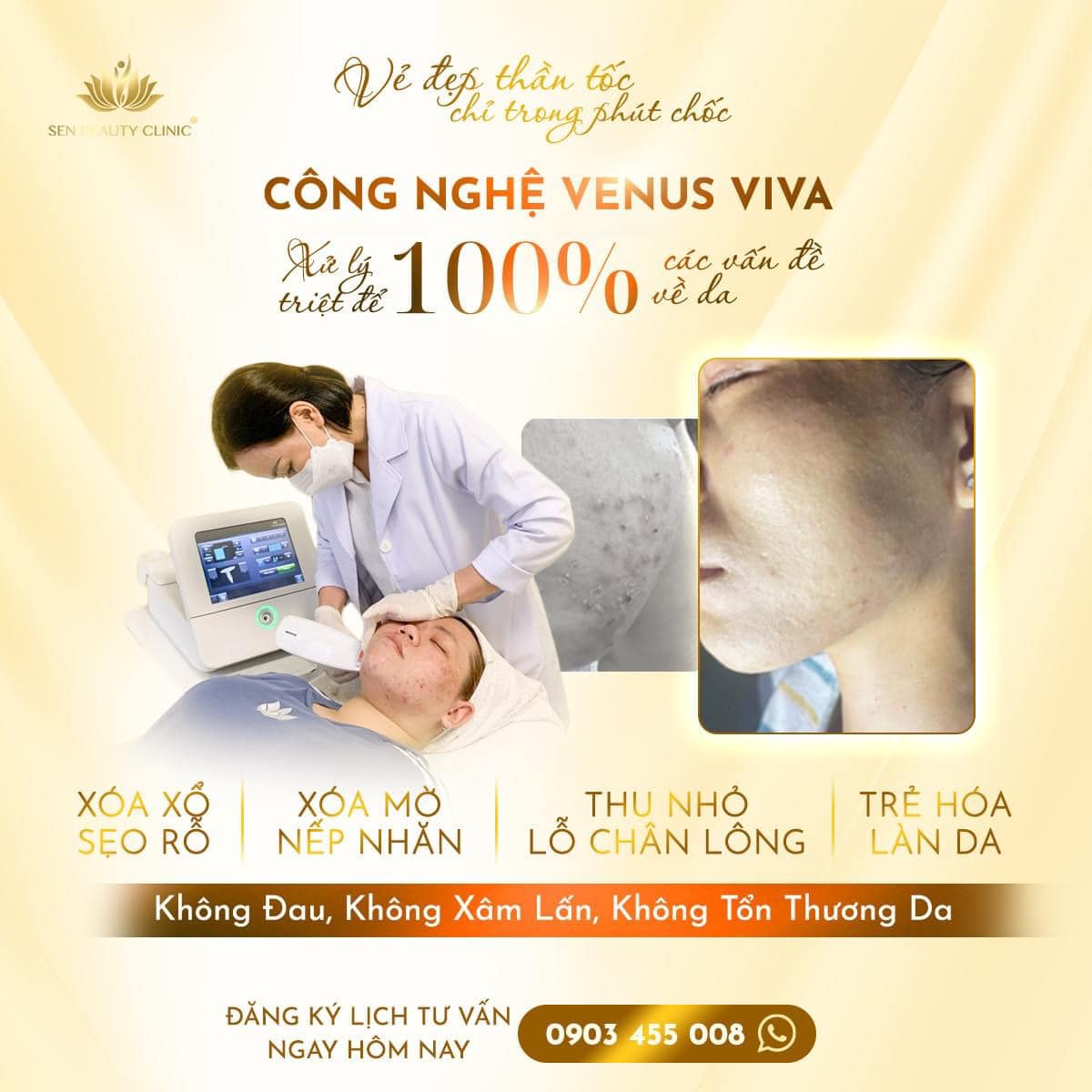 Sen River Spa Sài Gòn | Ho Chi Minh City