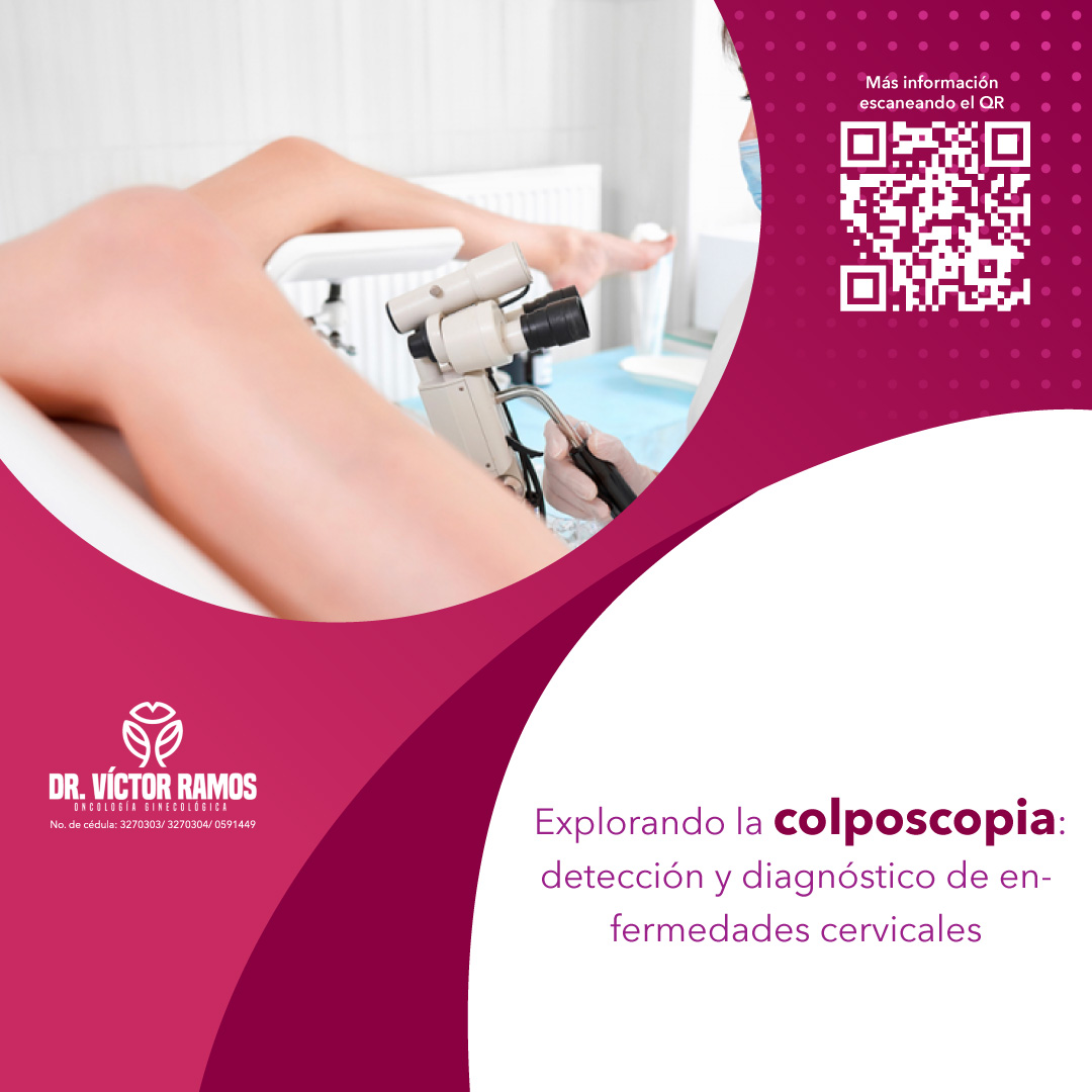 La colposcopia... - Oncología Ginecológica Dr. Víctor Ramos