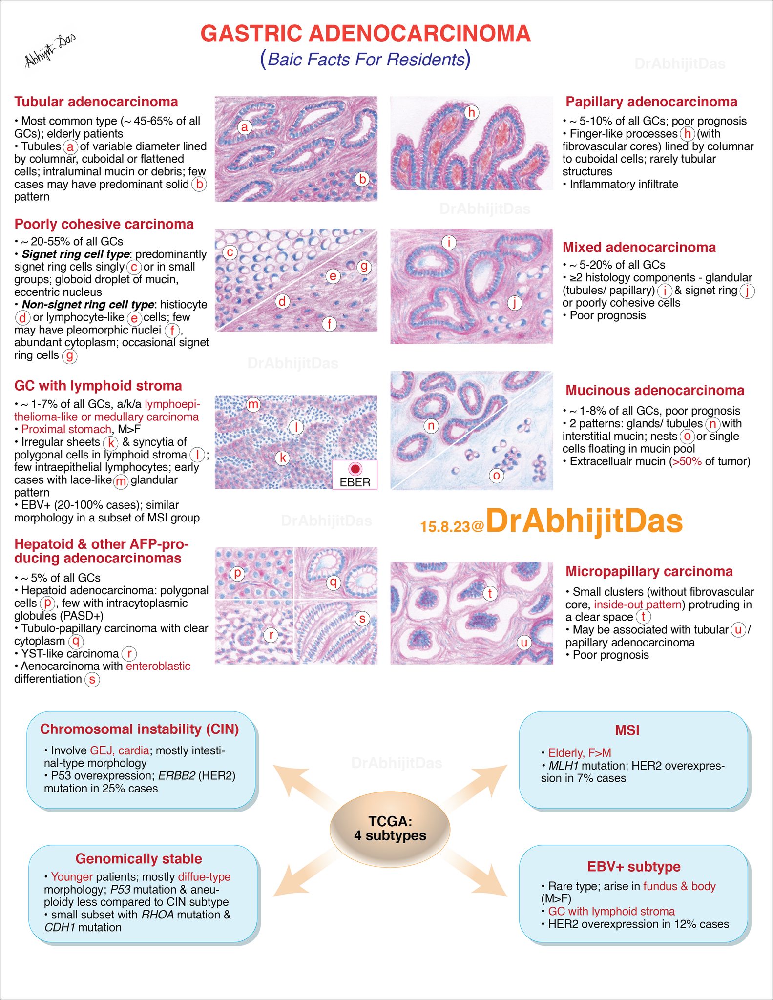 Dr.AbhijitDas, - Gastric cancer: basic facts for residents • Gastric ...