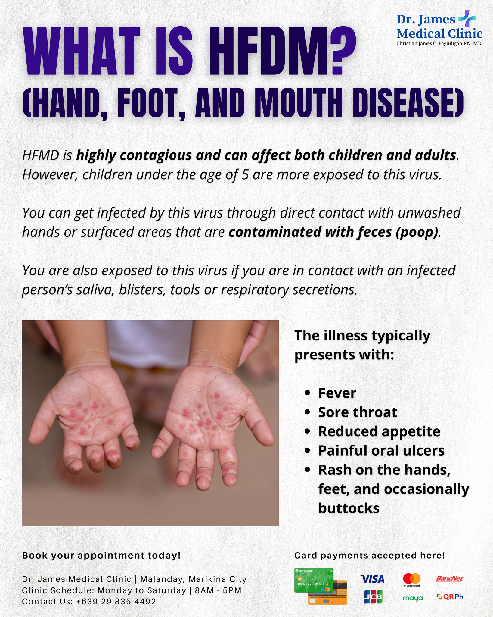 Dr. - We have observed a significant increase in Hand, Foot, and Mouth ...
