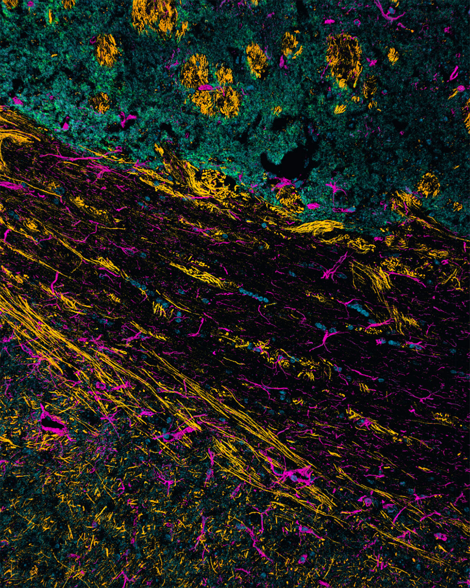 ZEISS - In our new case study, learn about the analysis of 3D spatial ...