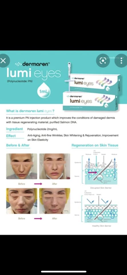 👀 LUMI EYES injectables 👀... - Harmony Cosmetics | Facebook