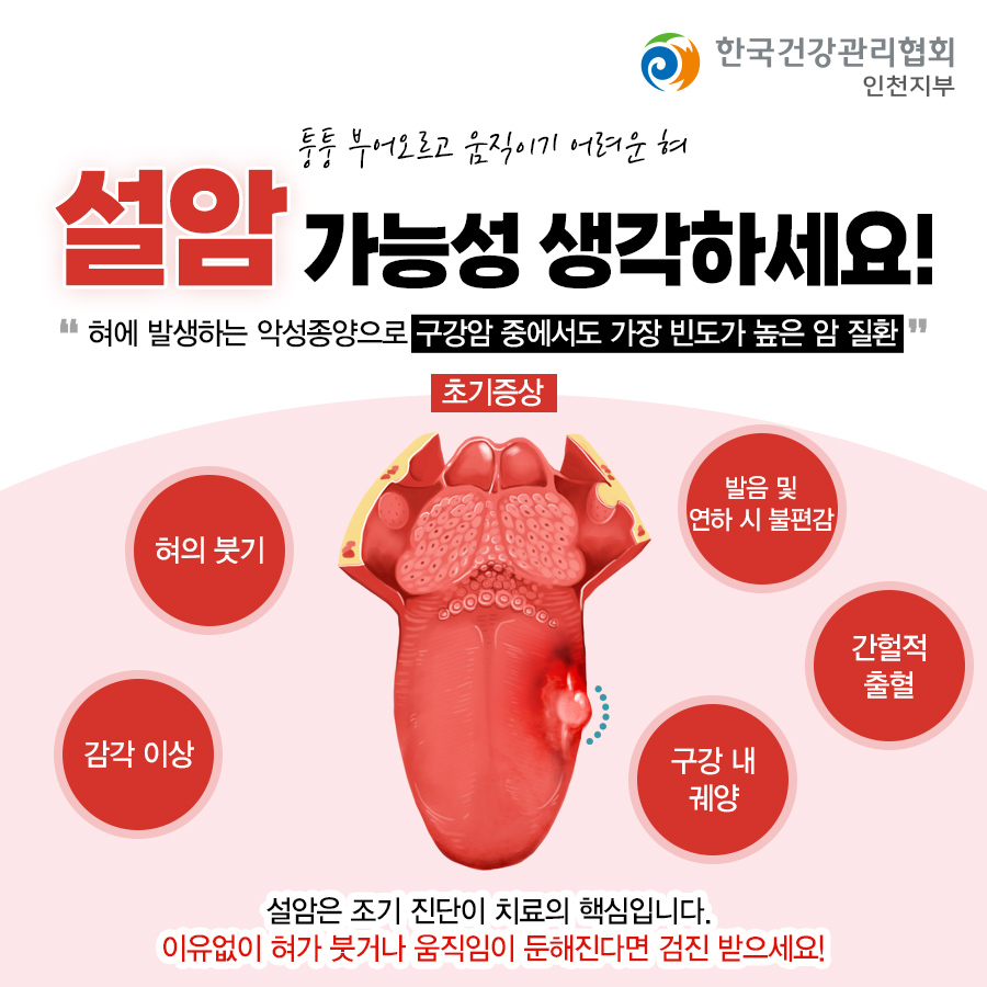 📢 설암 [설암이란?] 혀에 발생하는 악성종양으로 구강암 중에서도... - 한국건강관리협회 건강증진의원-인천