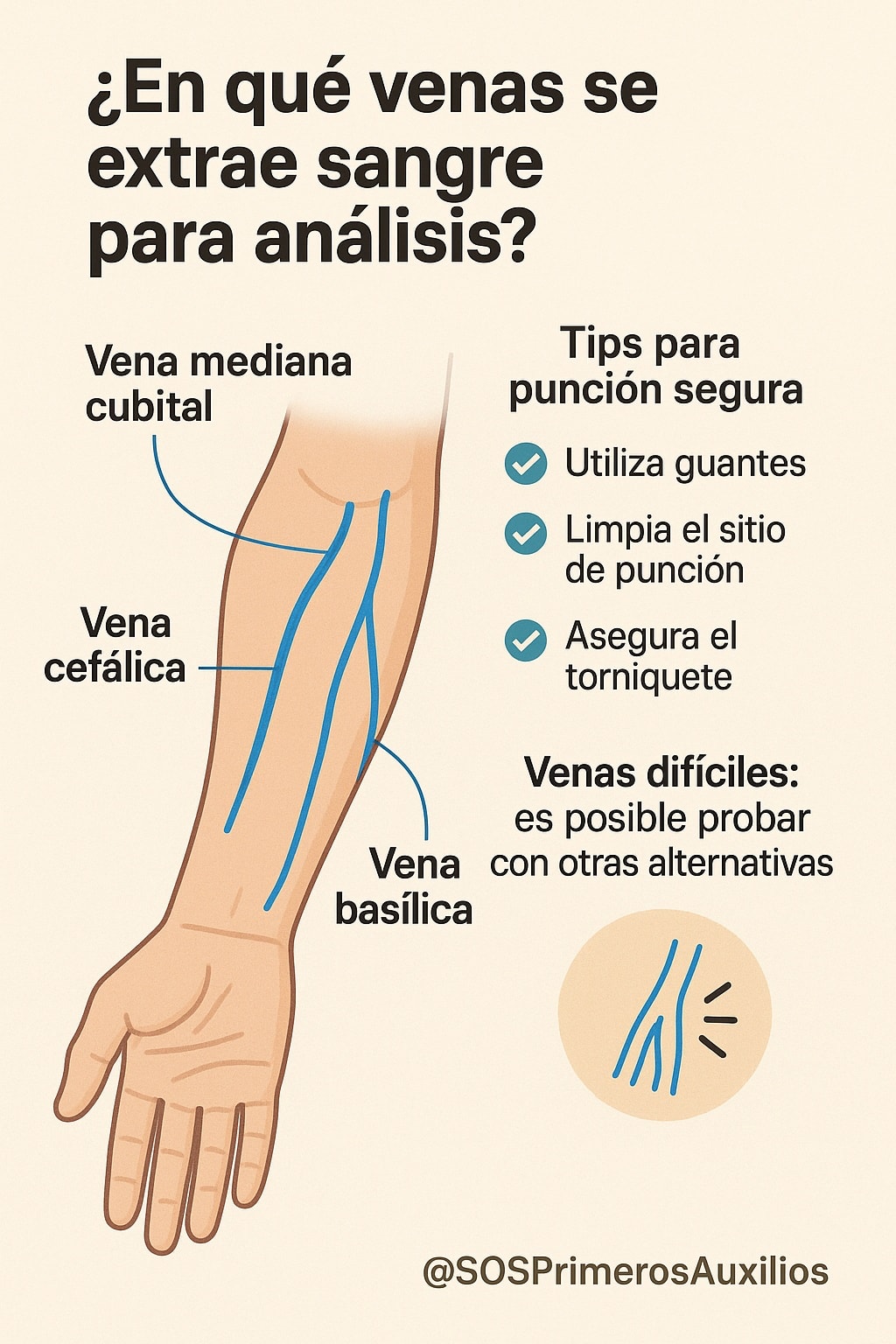 SOS - 🩸 Punción Venosa: Dónde y Cómo Extraer Sangre ¿Sabes cuáles son ...