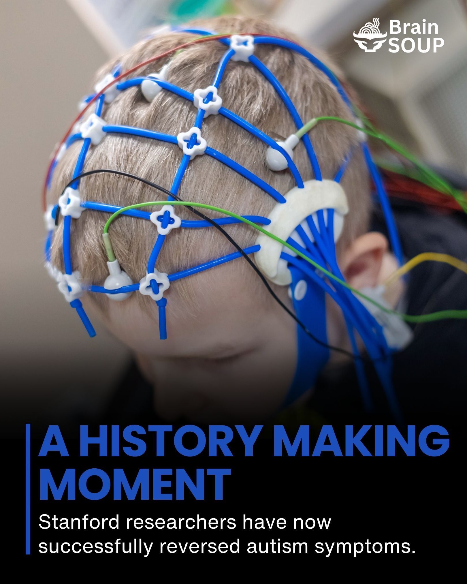 NATIONAL: New molecular map of brain could lead to targeted autism