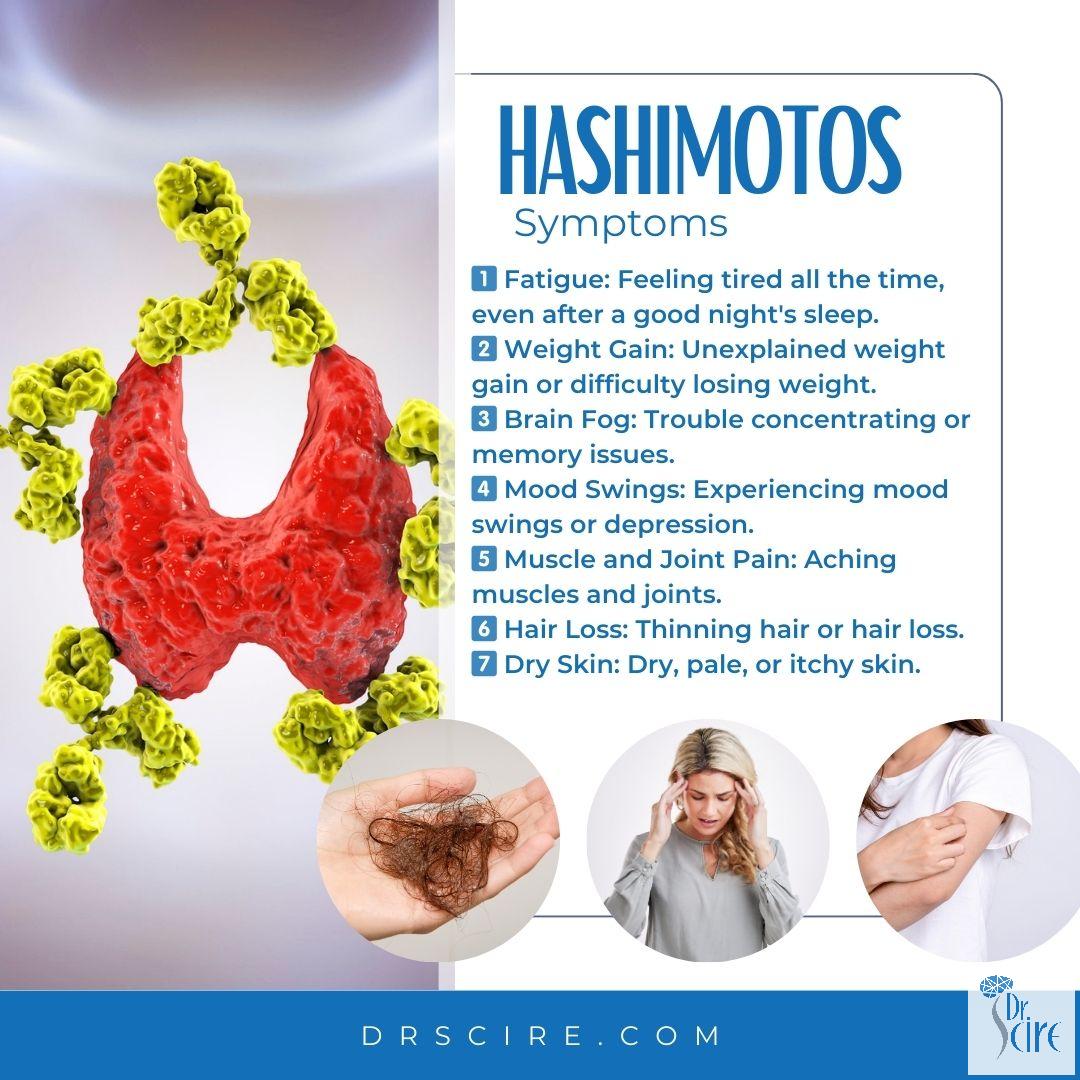 Peter Scire DC - 🌟 Understanding Hashimoto's: Recognizing... | Facebook
