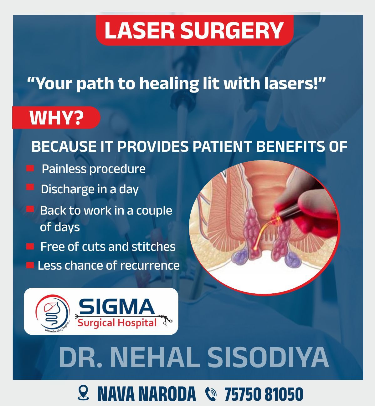 Sigma - LASER SURGERY 