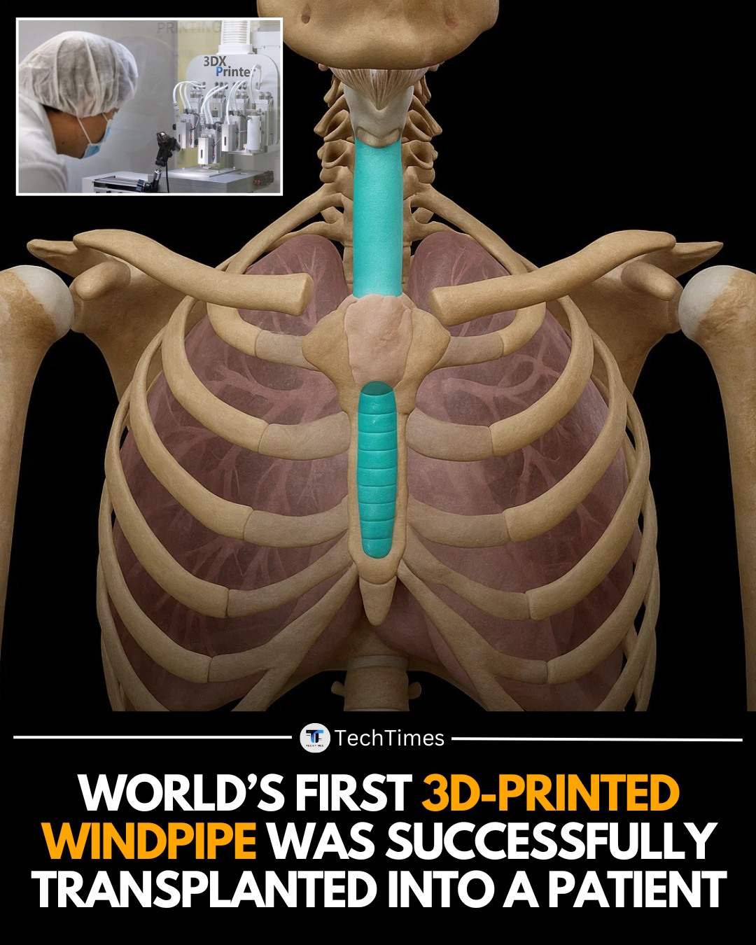 TechTimes - In a groundbreaking medical first, surgeons at Seoul St ...