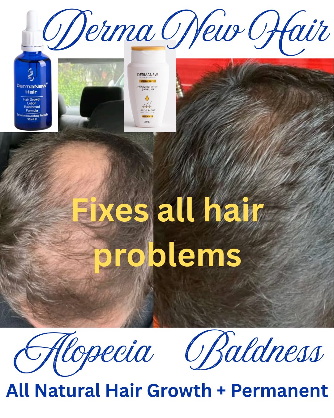 Derma Hair Growth | Ormonde Ext 5