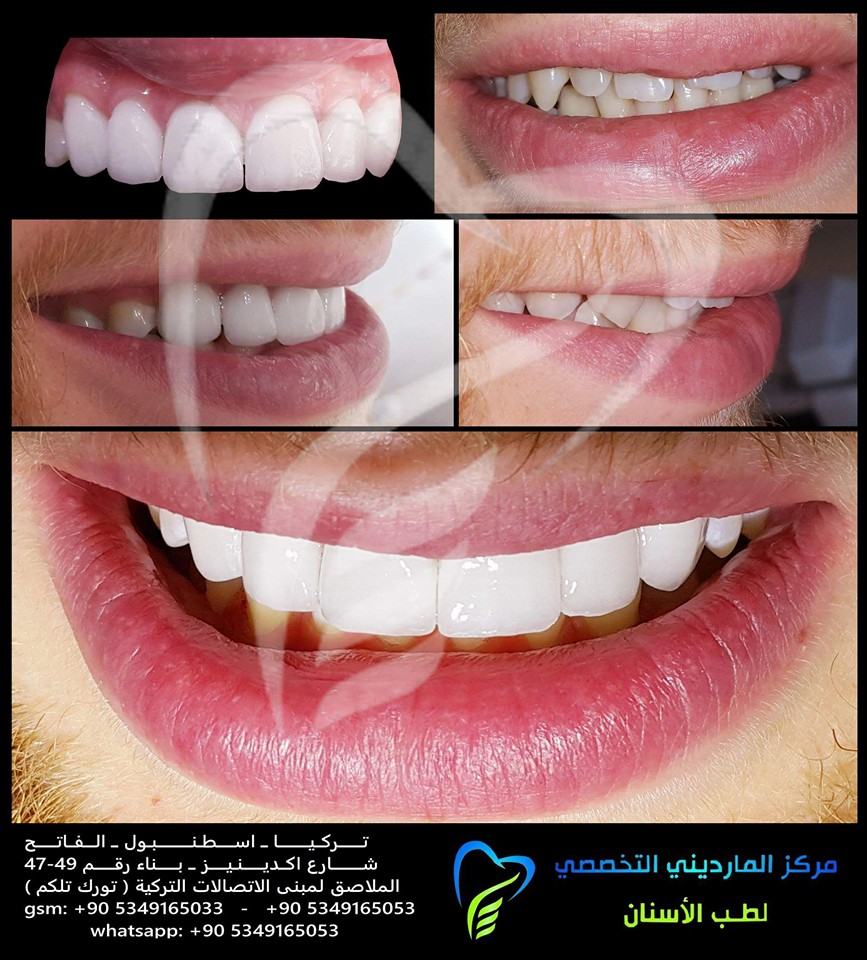 ماردين Home Facebook
