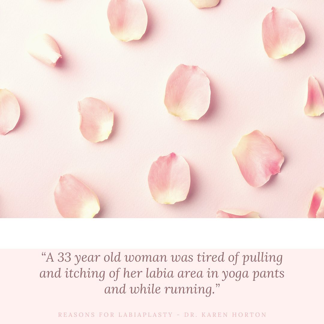 We can't share beforeandafter images of labiaplasty online but we can