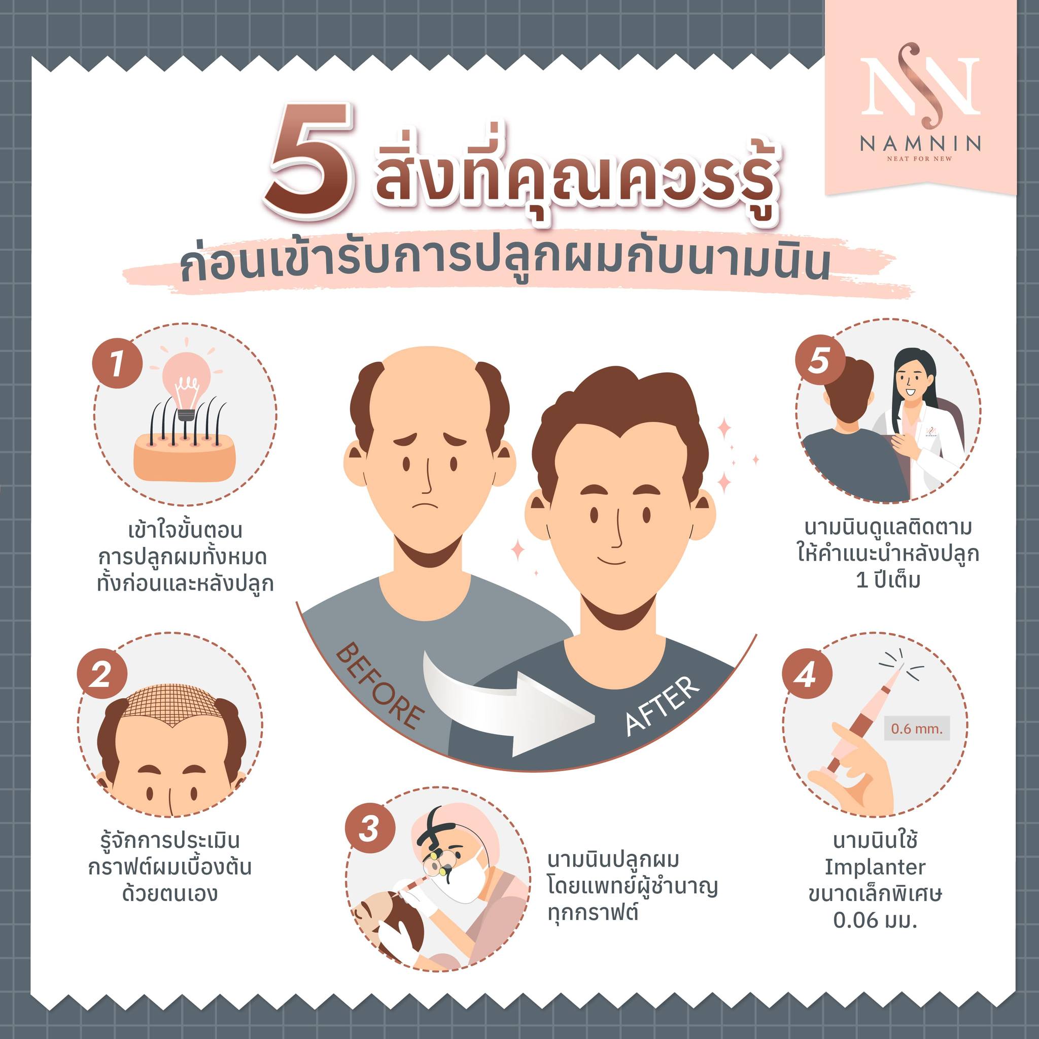 Namnin ForV clinic ปลูกผมถาวรเทคนิค NEAT โดยแพทย์ทุกกราฟ | Facebook