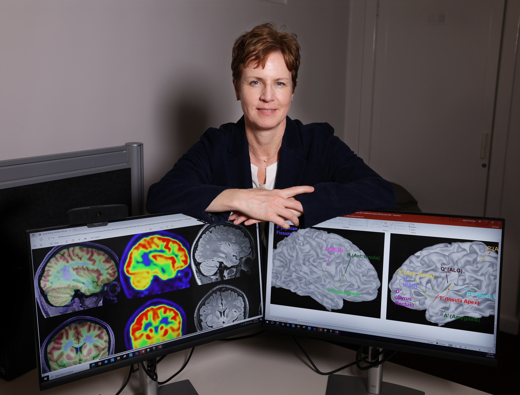 Mater - The Mater Epilepsy Unit is calling out for up to... | Facebook