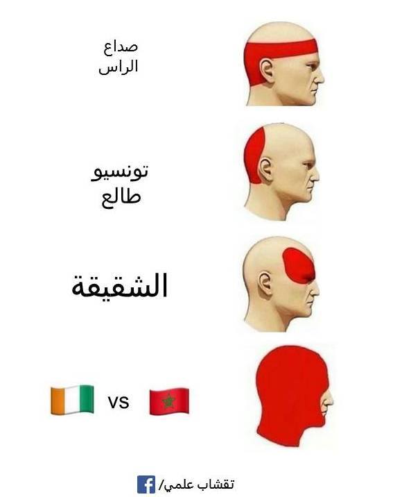 أنواع آلام الرأس Science Humor تقشاب علمي Facebook
