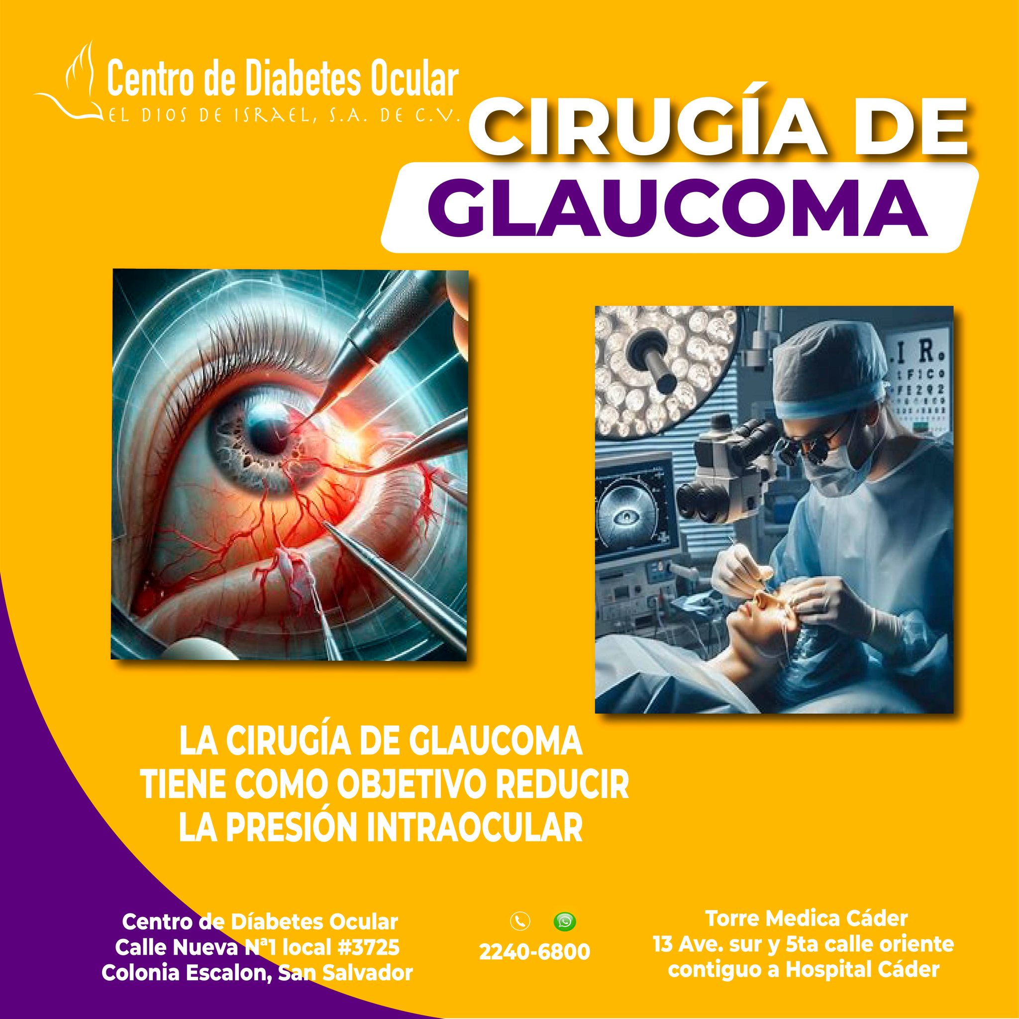 👉 El glaucoma es una... - Centro de Diabetes Ocular | Facebook