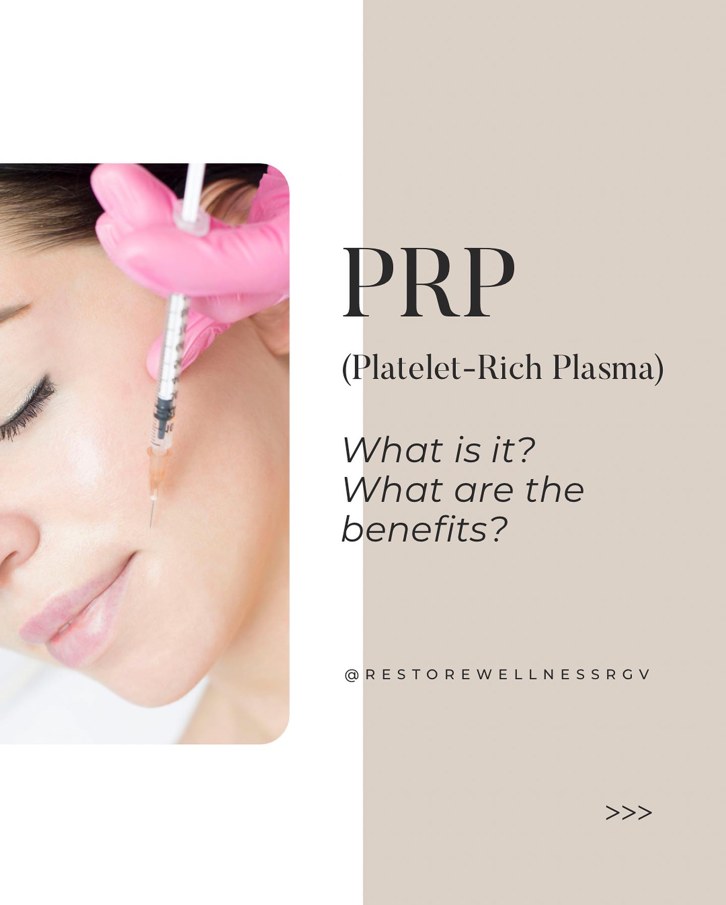 🩸 What is Platelet-Rich Plasma... - Restore Wellness RGV