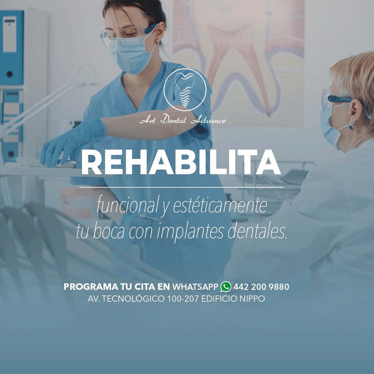 Art - Con ayuda de implantes dentales, puedes reponer dientes con ...