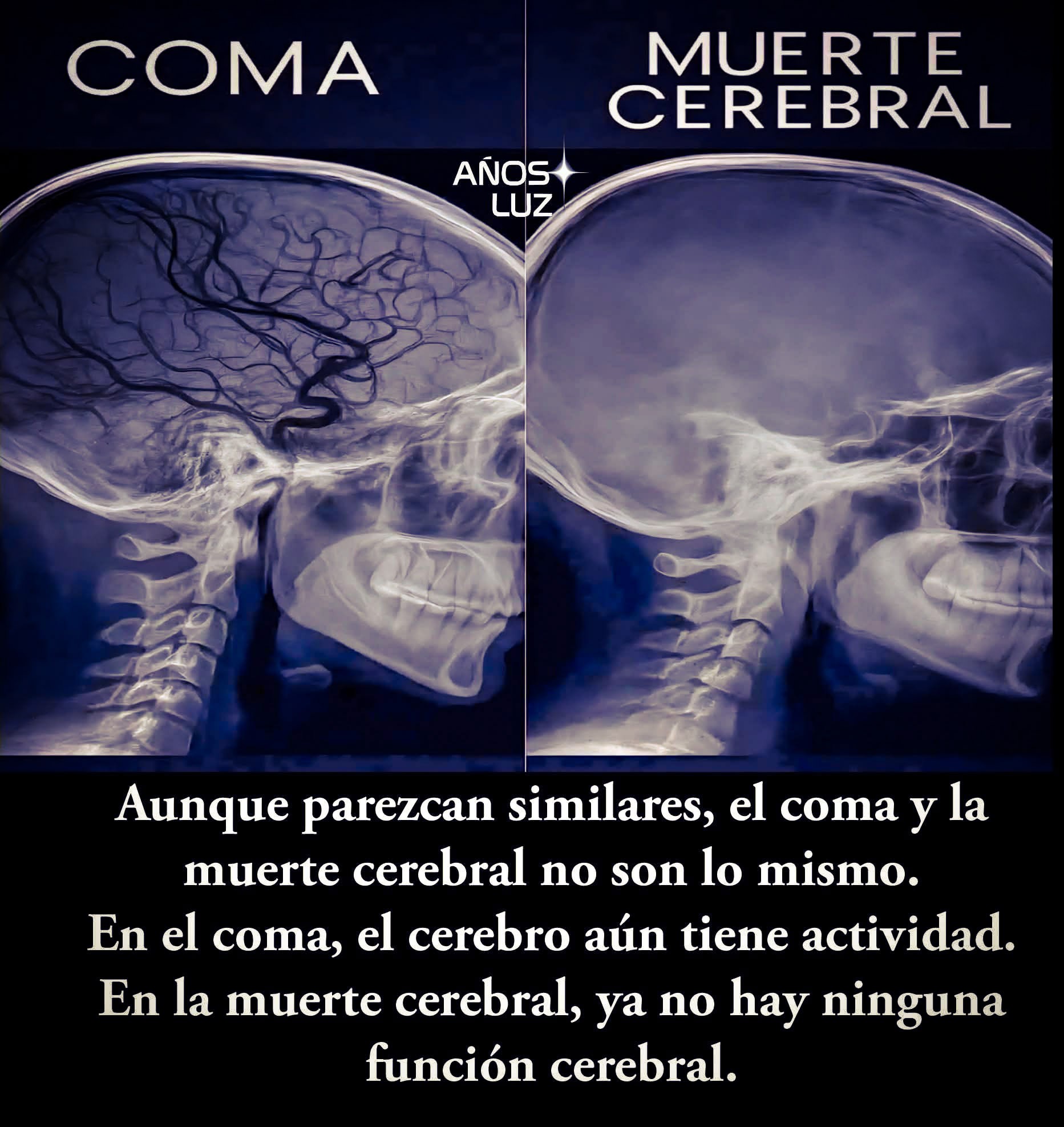 Años - 🧠 Coma vs. Muerte cerebral: no son lo mismo Aunque muchas veces ...