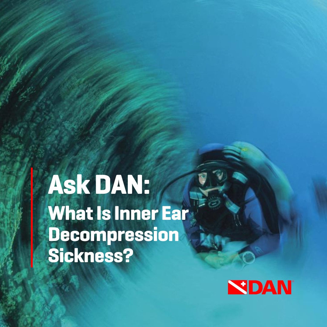 Scuba - What Is Inner Ear Decompression Sickness? 😵‍💫⁠ ⁠ Dizziness ...
