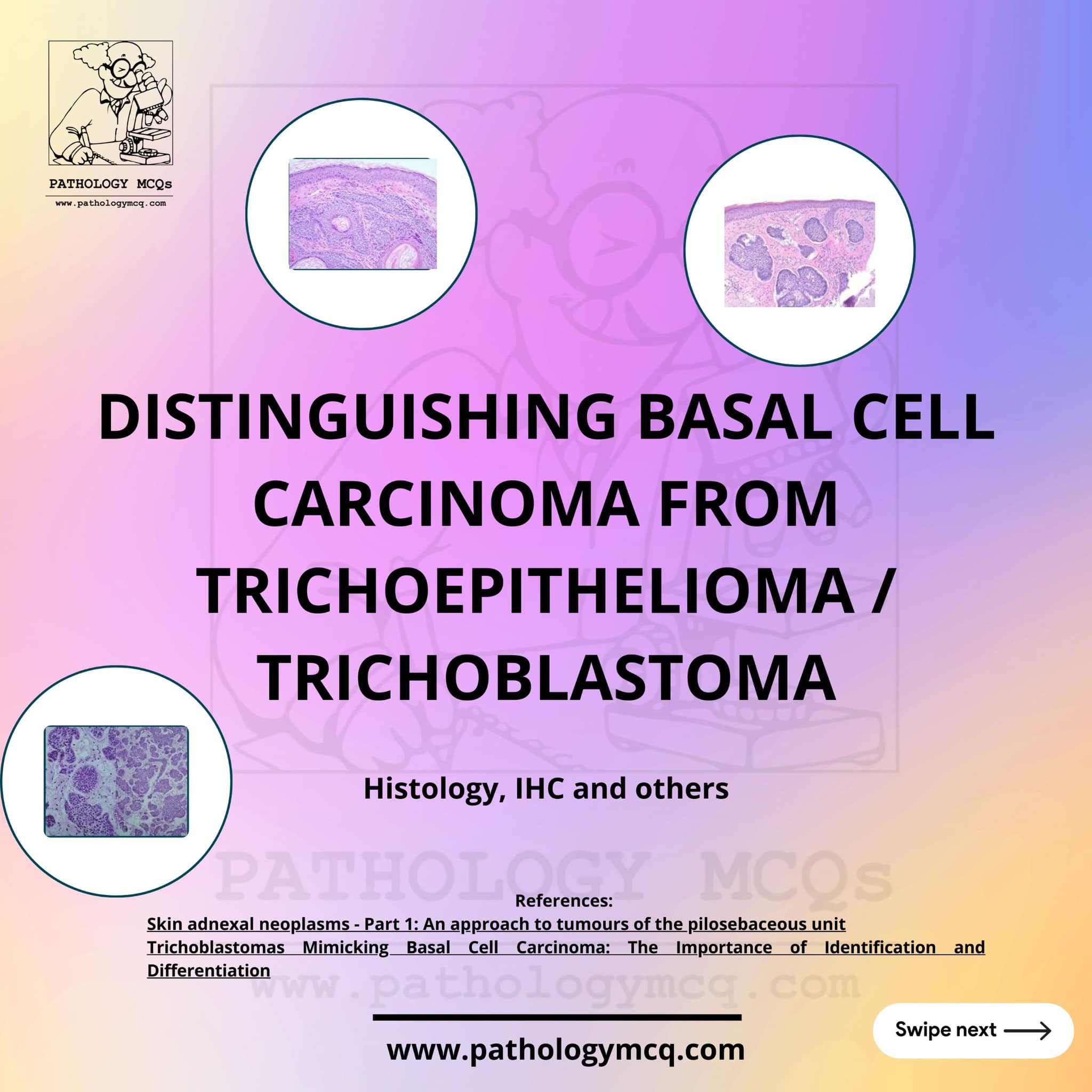 Pathology mcq - Tips to diagnose Basal cell carcinoma and...