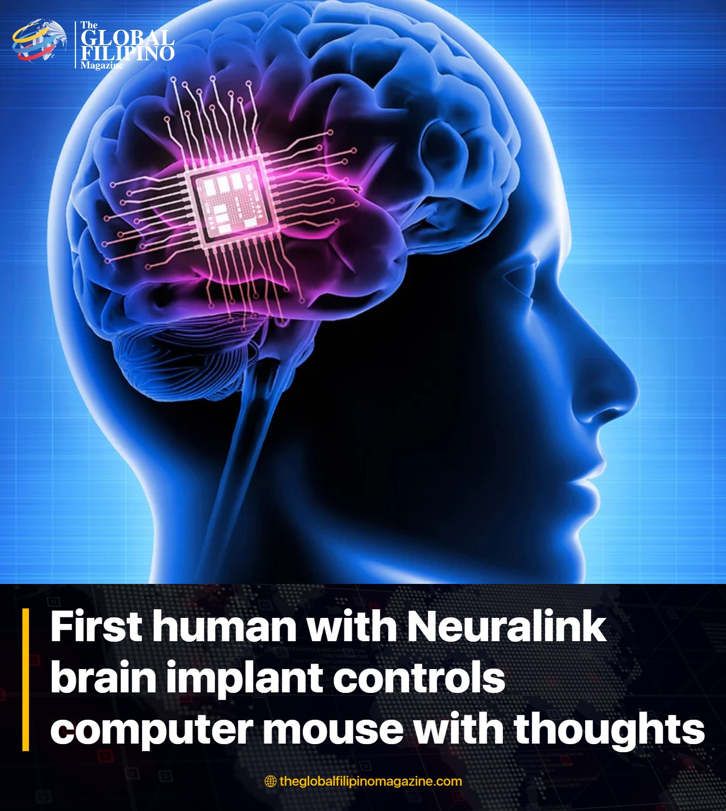 The Global - Elon Musk announced that the first human patient with a ...