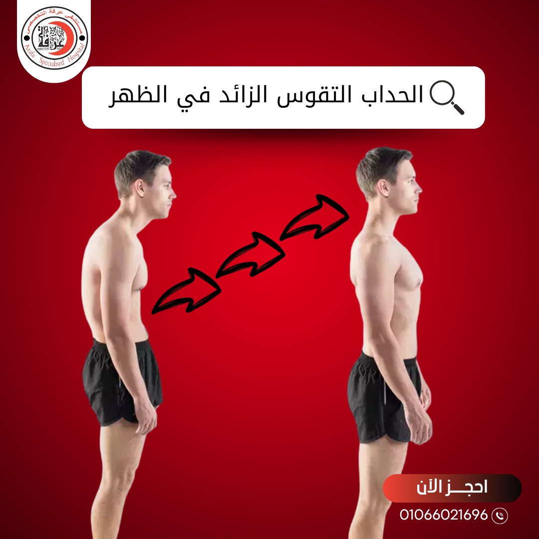 مستشفي - تقوس الظهر: الأنواع المختلفة للتحدب وأسبابها يعاني البعض من ...