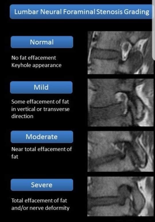 Learning Radiology