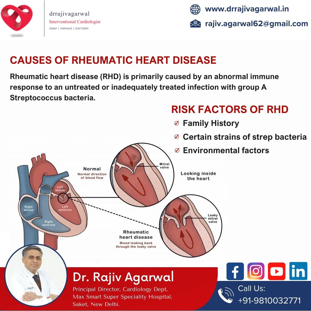 CAUSES OF RHEUMATIC HEART... - Cardiologist Dr Rajiv Agarwal