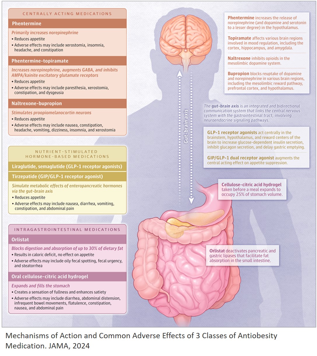 Medications for obesity can help promote weight loss and improve outcomes for people with type 2 diabetes, hypertension, and elevated lipid levels. This JAMA Patient Page describes the different types of medications