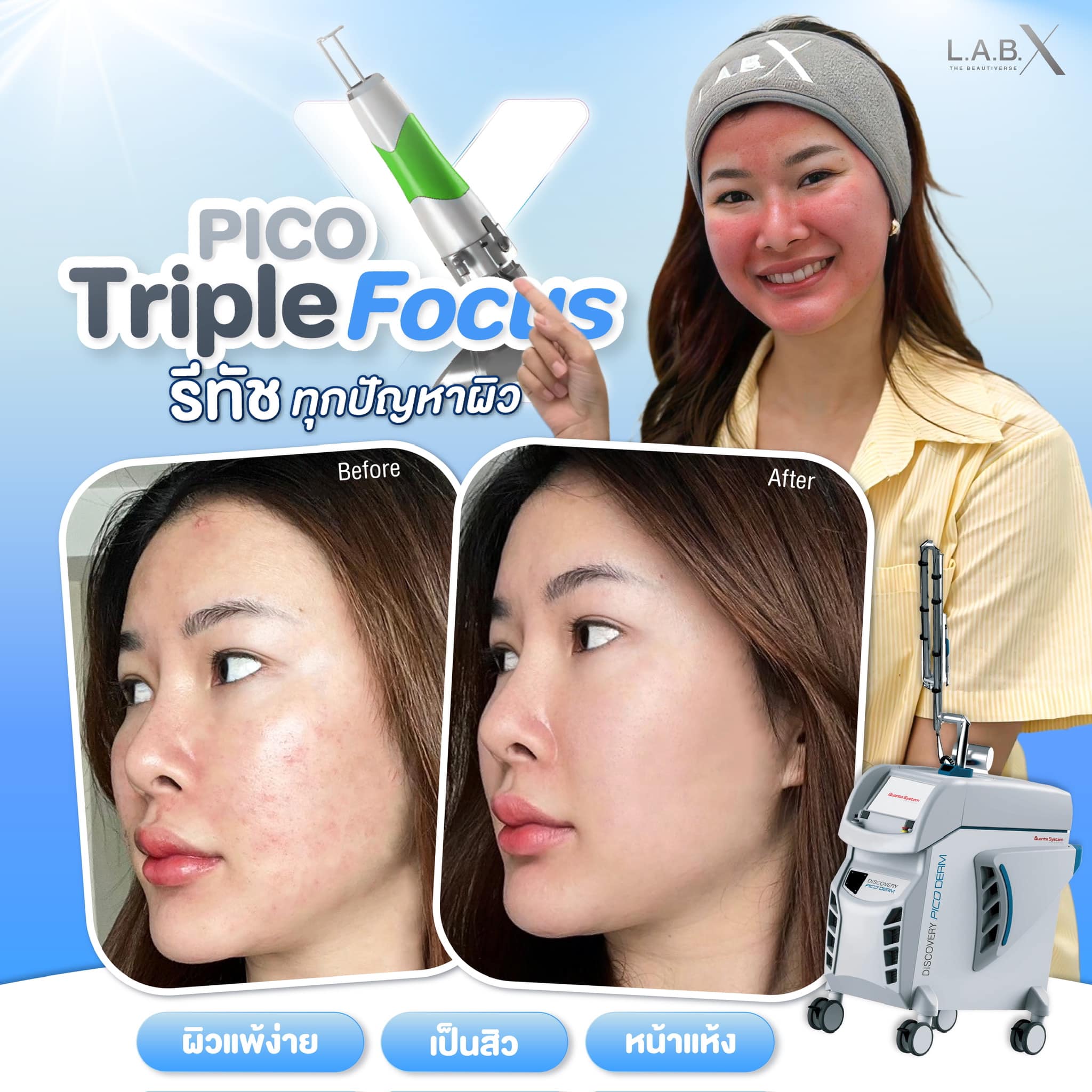 🎯 แพ้ง่าย เป็นสิว... - LABX Clinic ฟิวเจอร์พาร์ครังสิต