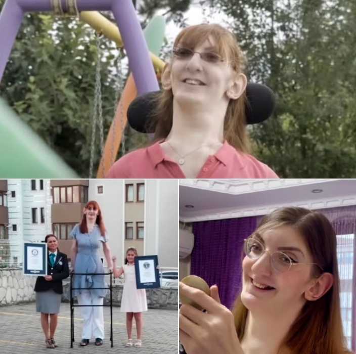 Love - Once mocked for her appearance and height, this remarkable woman ...