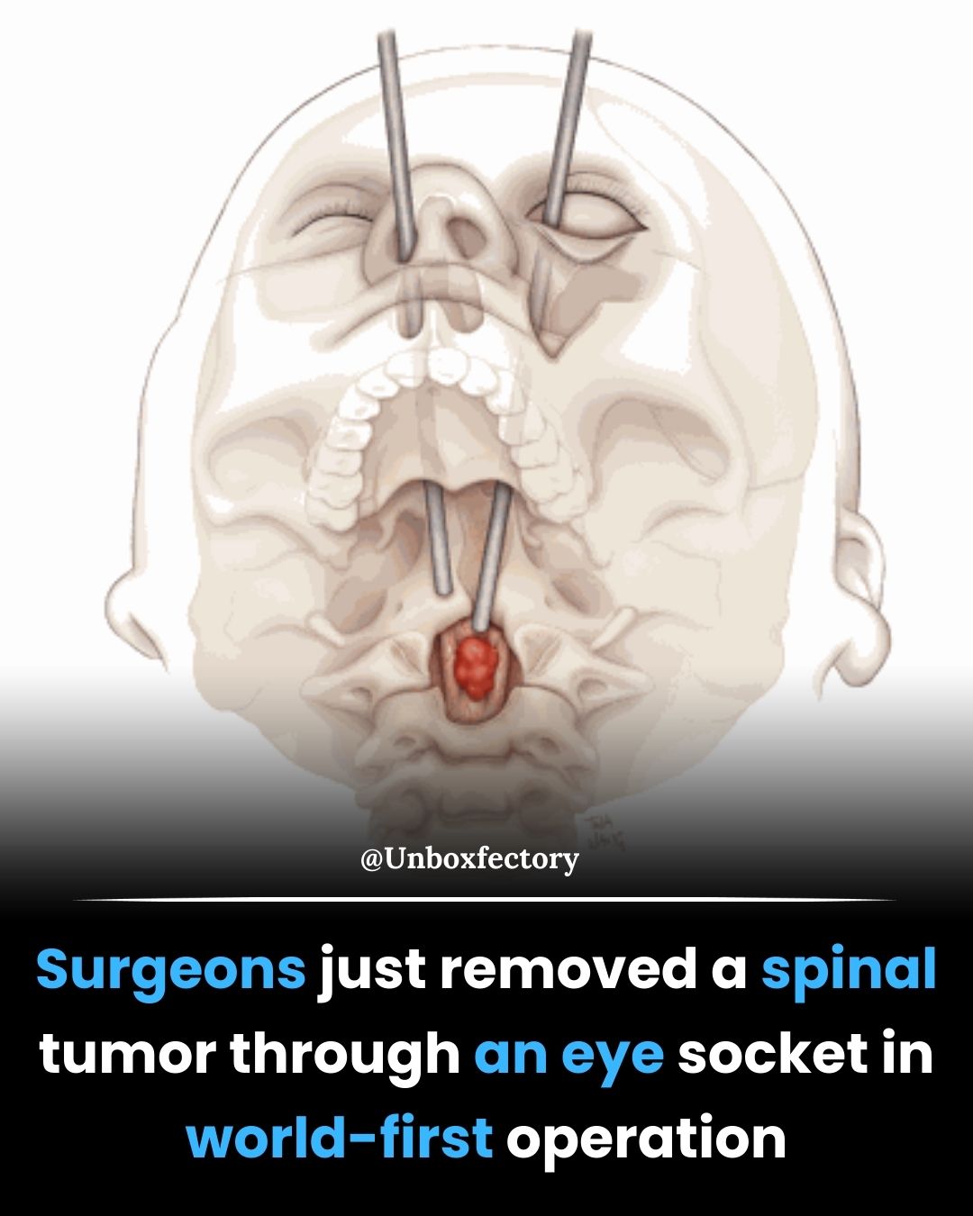 Dr. Rodolfo Maduri MD, Geneva, Switzerland published his