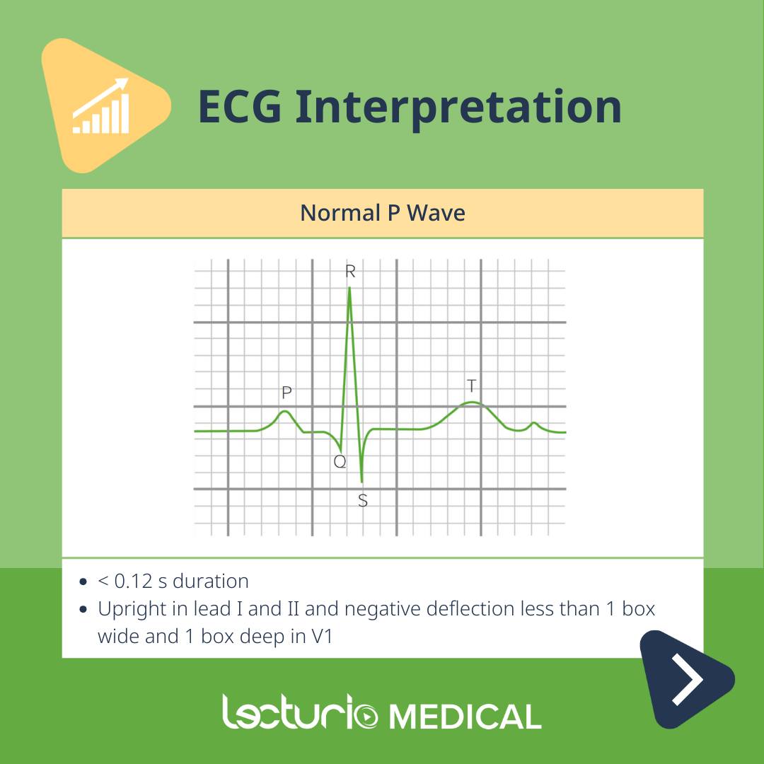 🩺 Understanding the Normal P Wave and... - Lecturio Medical