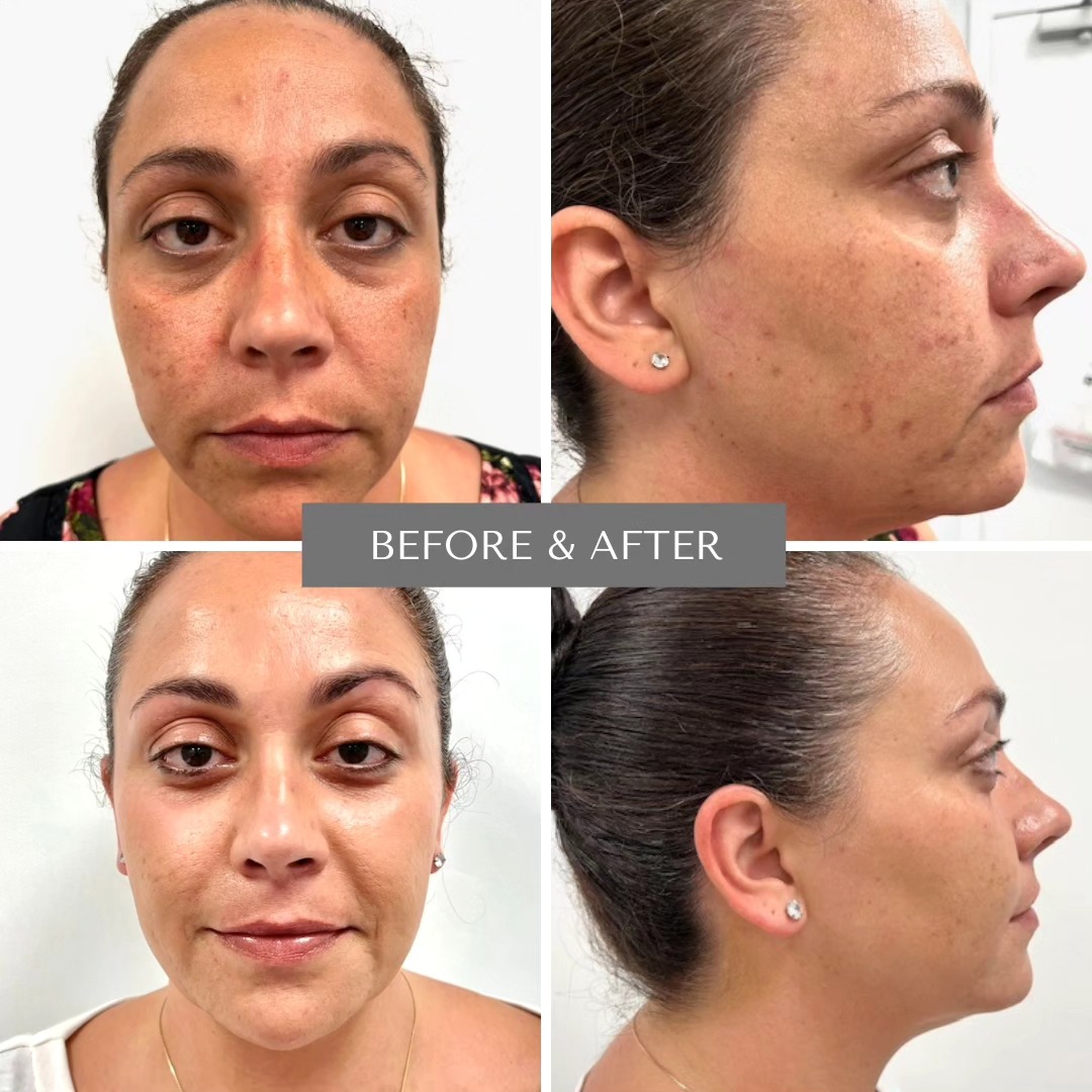 Environ Home Care- Clarity+Range. Office treatments consist of (6