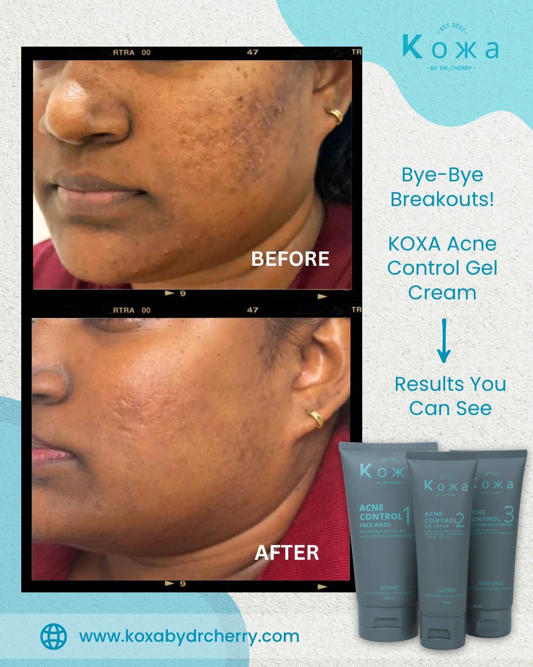 Koxa By Dr.Cherry | Colombo