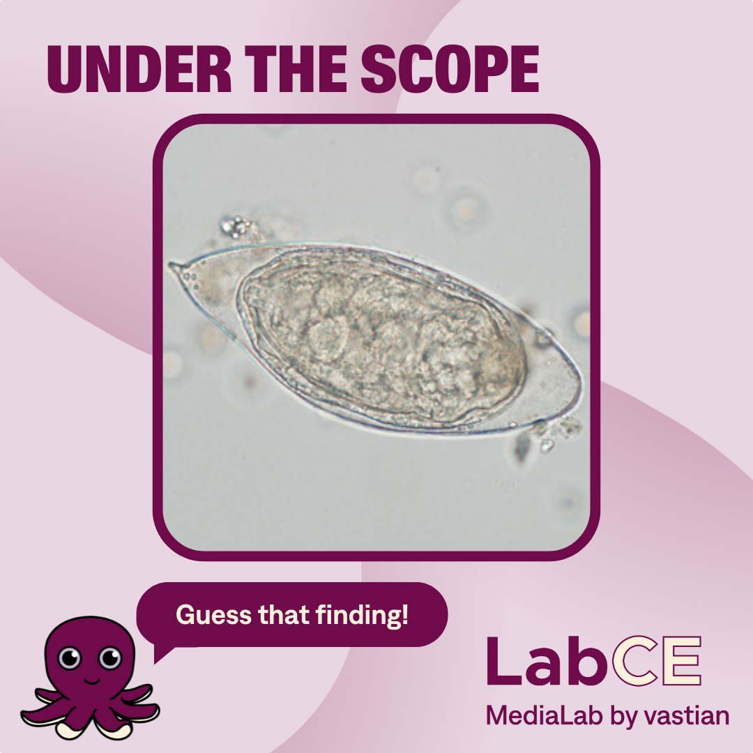 Labce by MediaLab added a new photo. - Labce by MediaLab