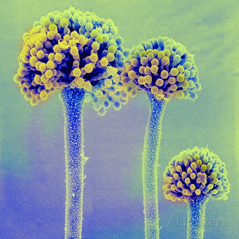 Microbe Notes - Conidia of Aspergillus, Scanning Electron Microscopy ...