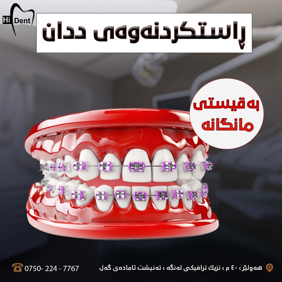 Hi-DENT - ڕاستکردنەوەی ددان بەقستی مانگانە. هەر بەڕێزێك ئارەزوی (نرخ ...