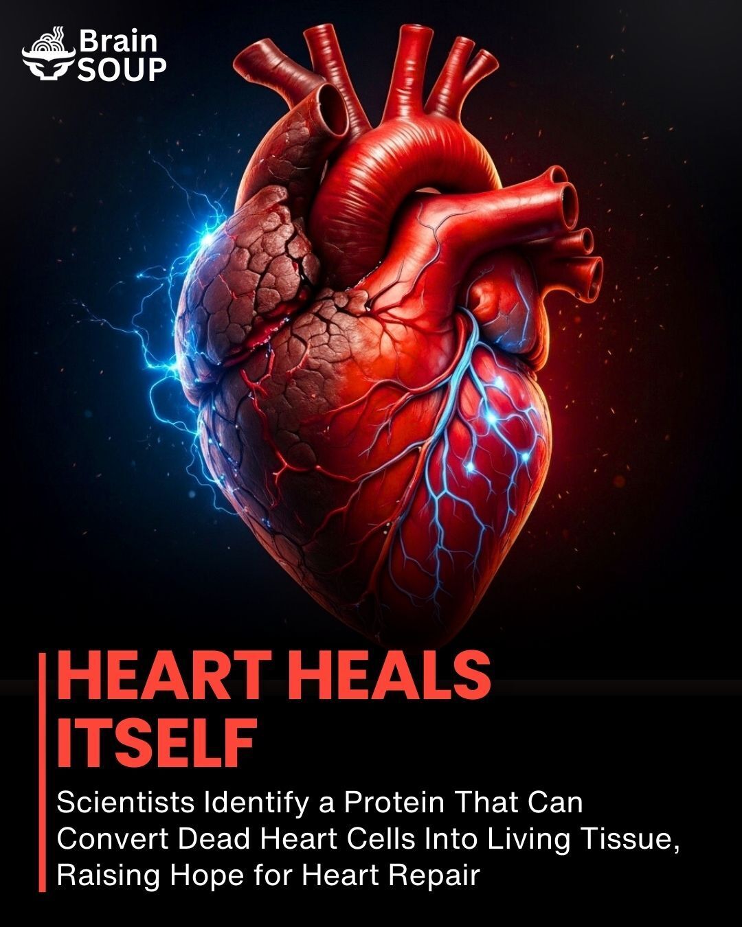 Brain - Scientists have identified a powerful protein that may change ...