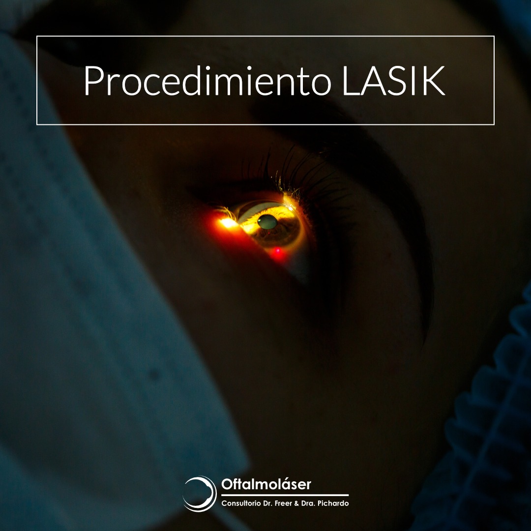 El procedimiento LASIK es una... - Clínica Oftalmolaser